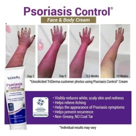 Crema Triderma Americana Rostro Y Cuerpo 119g Tipo De Piel Todo Tipo De Piel