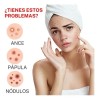 200pzs Mascarillas Estrella Para El Acne Espinillas Granos