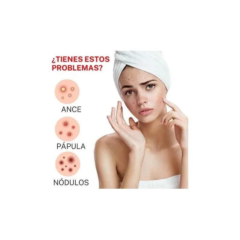 200pzs Mascarillas Estrella Para El Acne Espinillas Granos