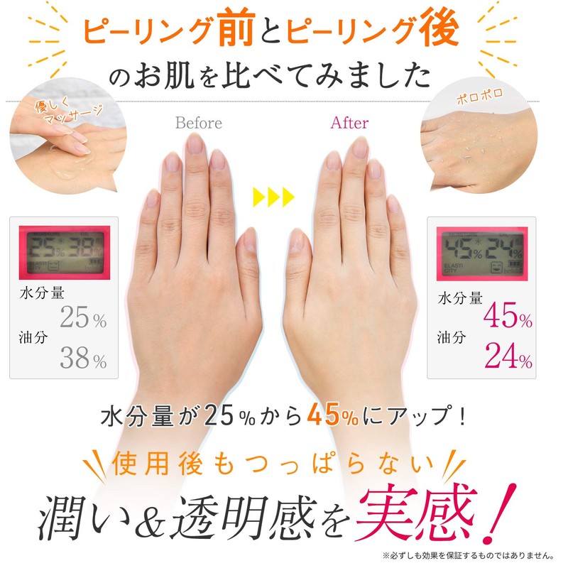 WAKARA Keratin Polo Polo Gel, Japanese to Big Size, 10.1
