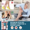 Crema Varicoso Contra Varices De 3 Piezas Para Fortalecer La