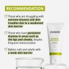 ZEROID | Intensive Oint-Cream | Face Moisturizer for Extremely Dry