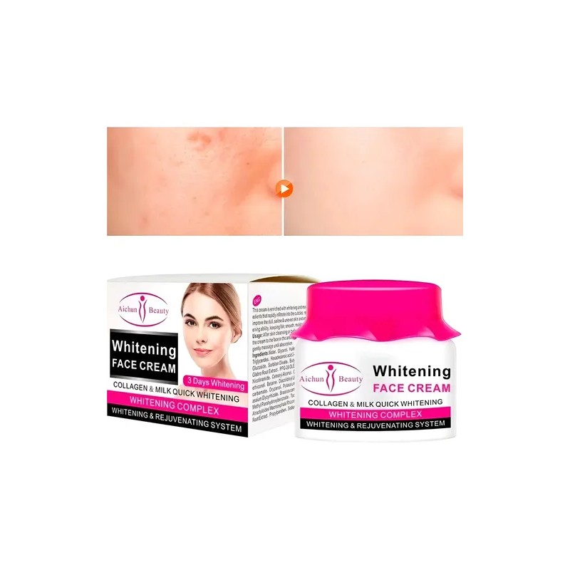 Aichun Crema Facial Remueve Manchas Oscura Aclaradora Todo Tipo De