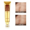Gel Reparador Aliver Cicatrices Acné Queloides Mixta 30 mL Día