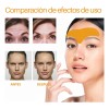 Kit para el cuidado de la piel Veraly Rostro Parches