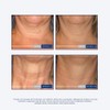 NeoStrata Skin Active Triple Firming Neck Cream, 2.8 oz