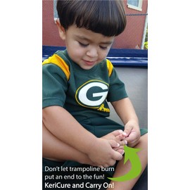 Kids Natural Seal Liquid Bandage Spray - 1oz Moisturizing Nanopolymer Barrier Spray for Custs & Scrapes - Sting Free Protection & Quick-Healing Formula - Mom-Invented - Made in USA