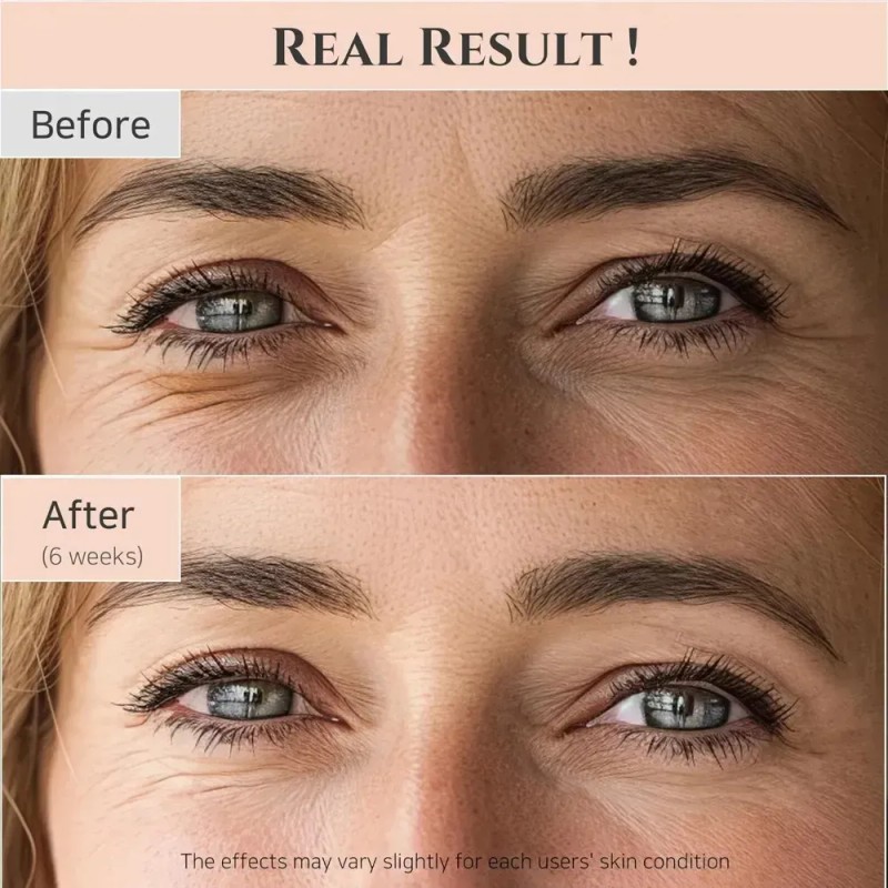 Srum Para Ojos Joseon Revive Beauty 2 -