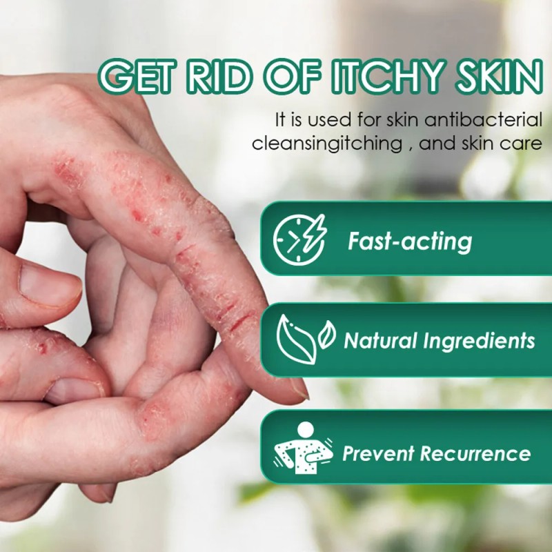 2×pomada Para Picazón, Psoriasis Musgo, Crema Para Dermatiti