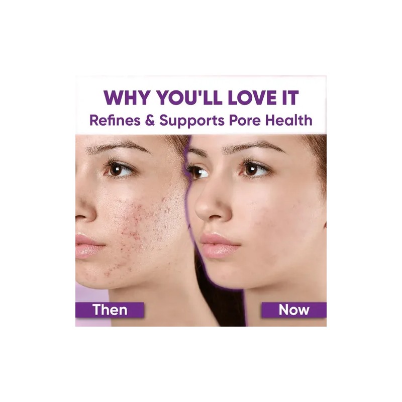 Anti-imperfecciones Y Aclarante Piel Acneica