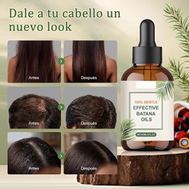 2 PCS Aceite de Batana, 120ML aceite de Batana para el Cabello, Aceite de Romero, Mejora las Puntas Abiertas y la Caída del Cabello para Hombres y Mujeres
