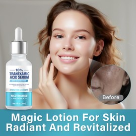 Tranexamîc Acid 10% Serum, Discoloration Correcting Serum, Natural Dark Spot Remover for Face, Hyaluronic Acid & Niacinamide