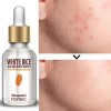 Rorec Serum Facial Arroz Rorec Antiedad Hidratante 15ml
