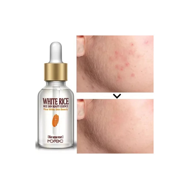 Rorec Serum Facial Arroz Rorec Antiedad Hidratante 15ml