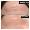 The pHix Philler Peptide Serum Duo - Daily Peptide Serum