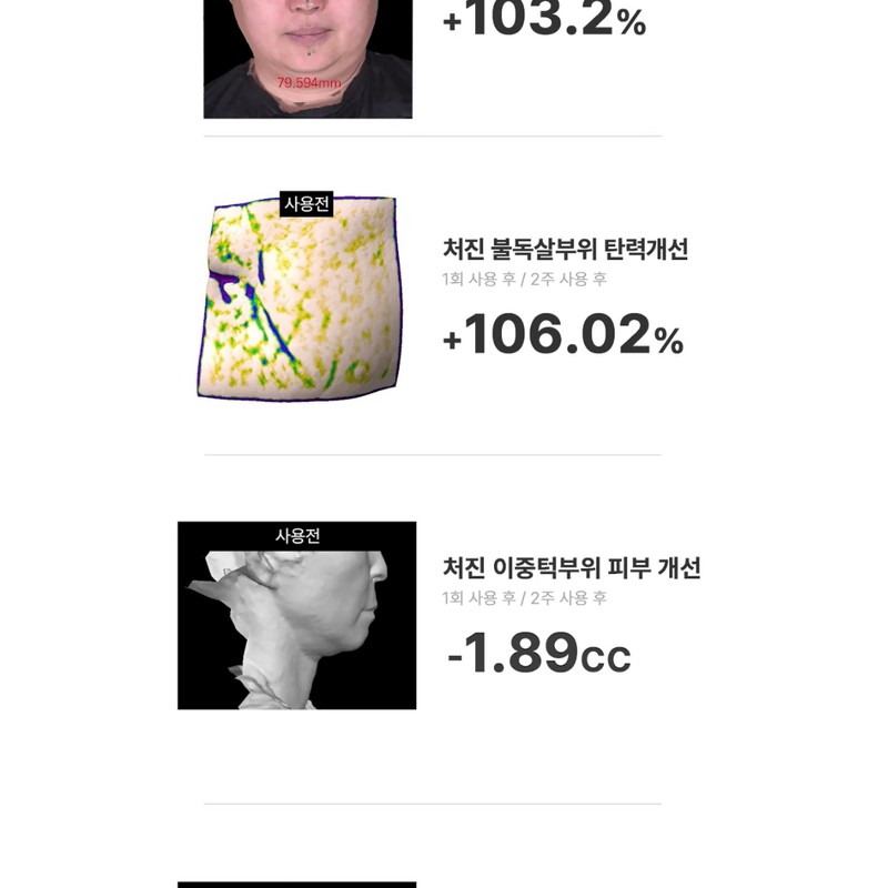 BEAUND Nmode PRO upgraded V-line massager / BEAUND 앤모드 PRO