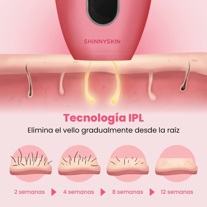 Depiladora Ipl Pro Shinnyskin Luz Pulsada Permanente Color Rosa