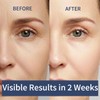 2PCS Calcium Volume Multi Balm, Calcium Multi Balm Stick, Vitaliq