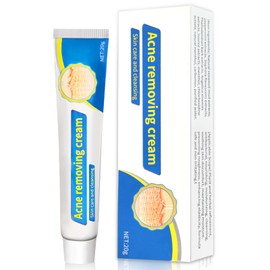 20g Anti Pickel Gesichtscreme, Anti-Akne Gesichtscreme, Pickelpaste für Männer und Damen, Fettgranulat Milienentferner, Hautberuhigend, Face Skincare, für Ebenmäßige und Strahlend, Weiß