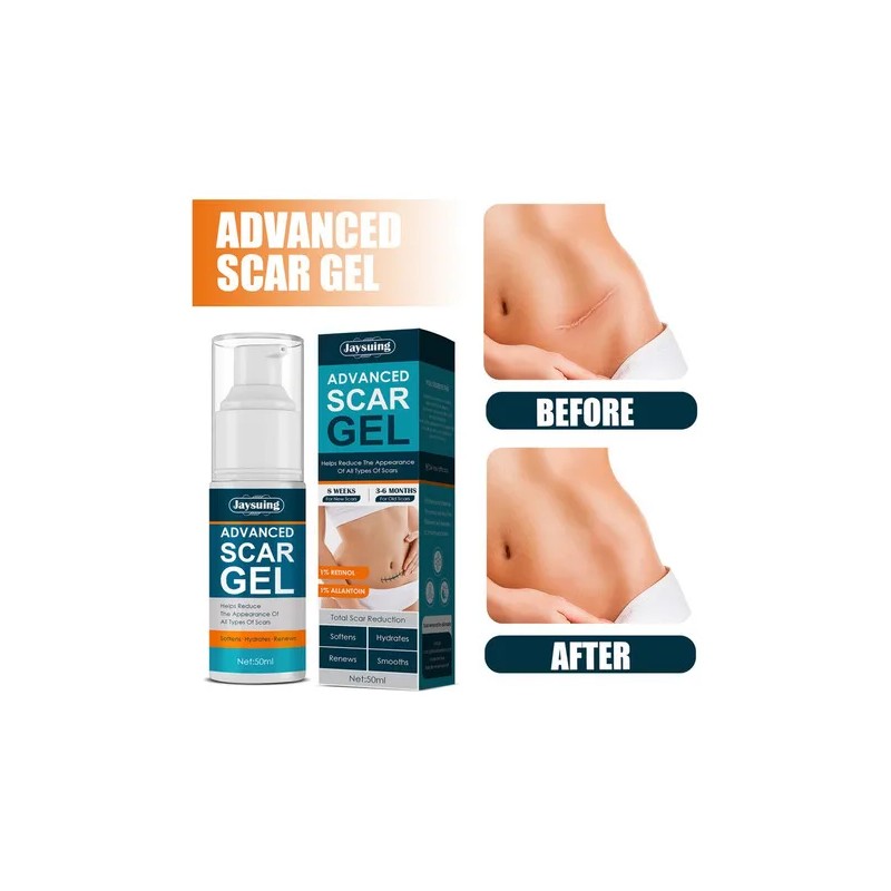Crema Para Cicatrices En Gel Queloid Acne Removal Treatment,