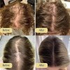 Aceite Esencial Para El Cuidado Del Cabello Con Plantas De