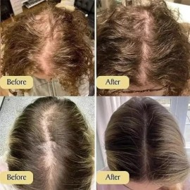 Aceite Esencial Para El Cuidado Del Cabello Con Plantas De R