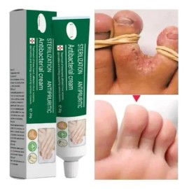 Fc Crema Para Eliminar Lo Hongo En Los Pies Alivia La