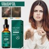 Aceite De Foliculitis Del Cuero Cabelludo, Natural Y Nutriti