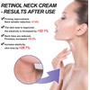 🌸 Crema Reafirmante para el Cuello – Antiarrugas y Reductora