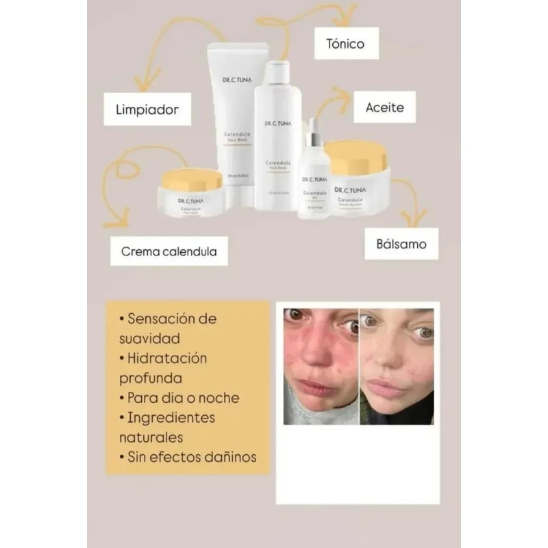 Set Caléndula 5 Productos Para Piel Seca/sensible, Farmasi