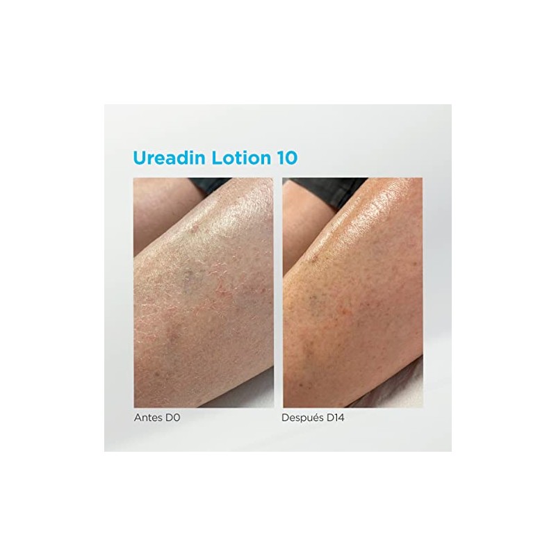 Ureadin Massage Oils 30 ml