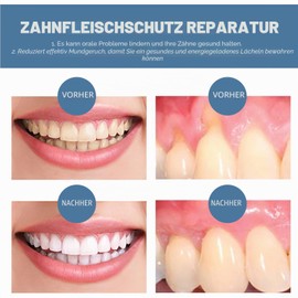 KOAHDE Gum Offspring Gel, Teeth Cleaning and Whitening, Treatment for Gums and Teeth Whitening, Gum Restoration, Teeth Whitening - Gum Growth, Teeth Whitening Gel, 6 Pieces
