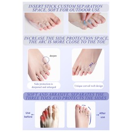 Hewaomm Bunion Corrector Toe Spacers For Kids Man Women, Separators Toe Straighteners For Curled Last Three Toes, Spreade Feet Hammer Overlapping