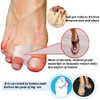 Skeerthy 16 Pieces Gel Toe Separators –Bunion Pads – Toe