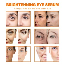 Turmeric Oil Facial Serum - Diminish Spots, Illuminate, Moisturize. Improves Skin Tone. For all Skin Types (10ML)