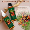 Aceite De Batana Orgánico Umpeimvon, Paquete De 2, 200 Ml