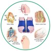 1 Pair Bunion Corrector Men Women Adjustable Discomfort Relieve Toe