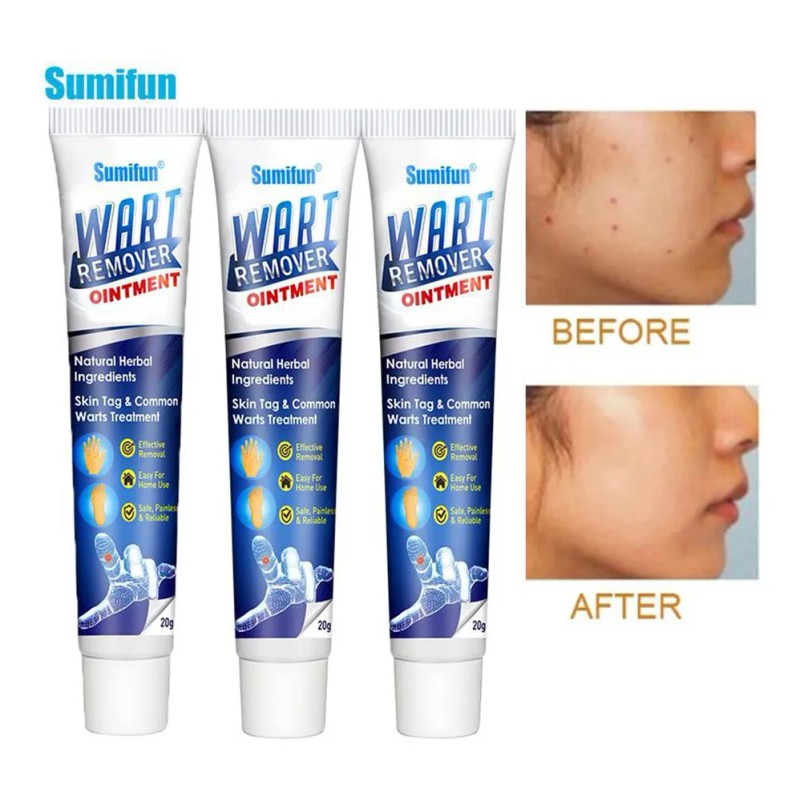 Pomada Para Callos Y Verrugas De Ojos Planos