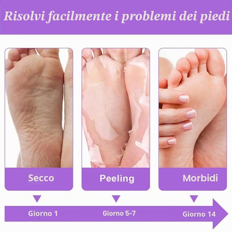 QOCUILC 2 Paia maschera piedi secchi screpolati, Maschera piedi esfoliante,