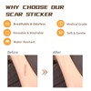 NAYSAYE Silicone Scar Tape, Silicone Scar Sheets for Surgical Scars,