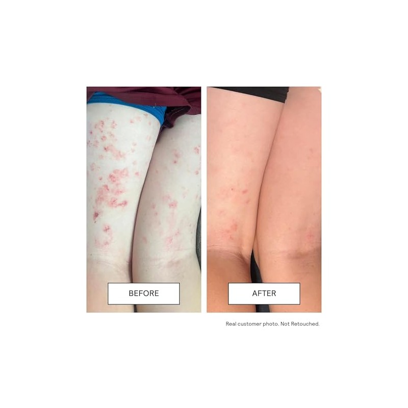 Untoxicated Moisture Boost Hydrating Cream for Sensitive Skin with Ceramides