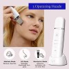 Mosen Limpiador Facial Ultrasonico Exfoliante Portatil Limpieza
