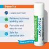 FixMySkin 1% Hydrocortisone Healing Body Balm, 0.5 oz