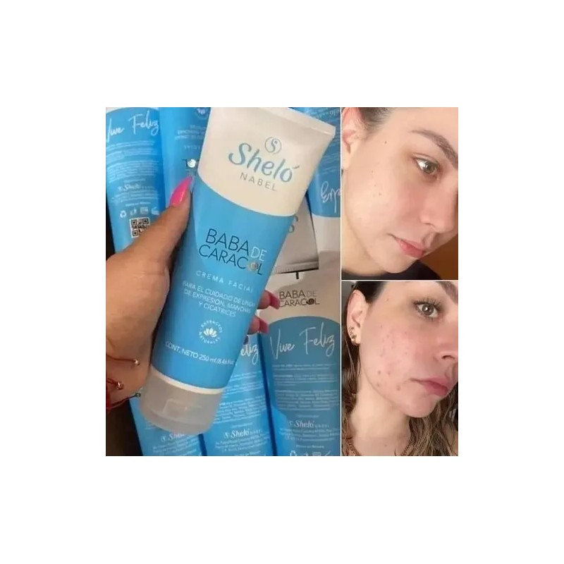2 Pack Crema Facial Jabón Baba Caracol Sheló Nabel regalo