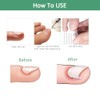 Professional Ingrown Toenail Treatment Set for Home Use