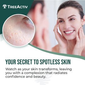 TreeActiv Spot Treatment 0.5oz + Remover Kit Bundle, Includes Spot Treatment and Remover Tool, Bentonite Clay, Tea Tree Oil, Aloe Vera, Clearer Skin in 2 Weeks