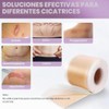 MXBEAUTY Parches de Silicona para Cicatrices