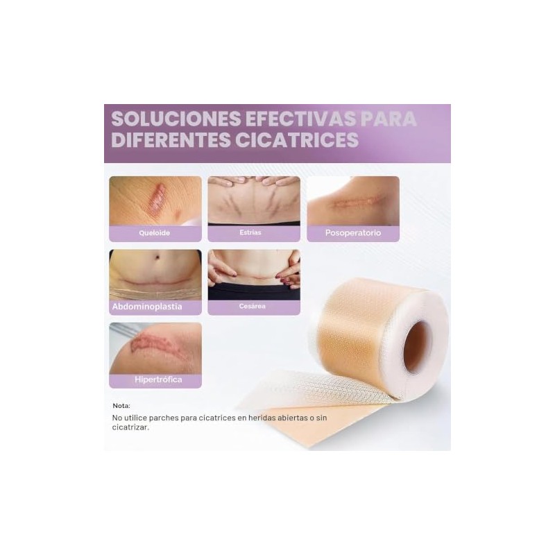 MXBEAUTY Parches de Silicona para Cicatrices