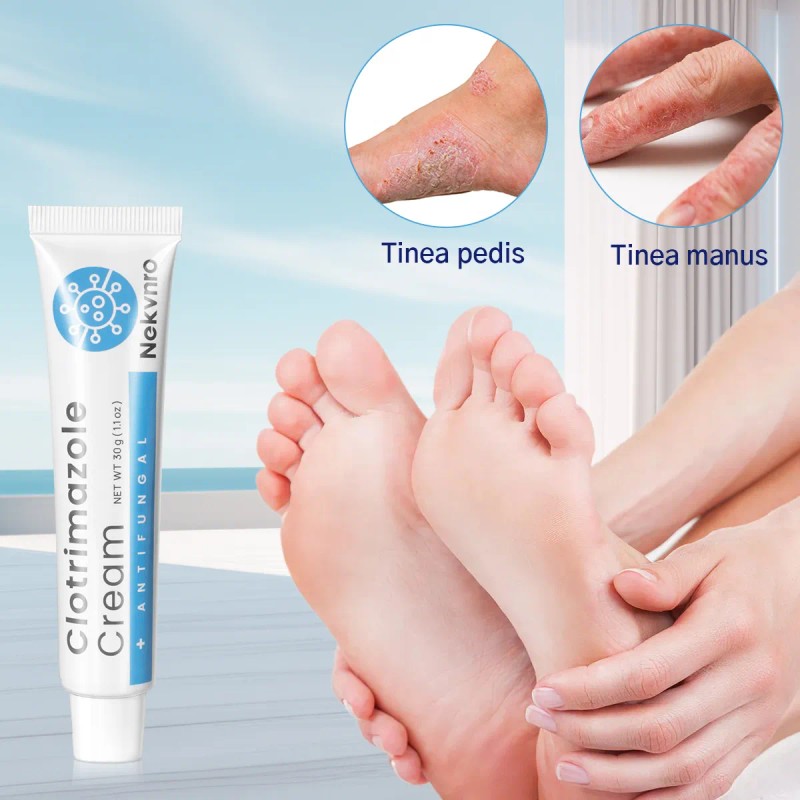 Nekvnro Crema De Musgo De Pies Para Musgo Bursátil