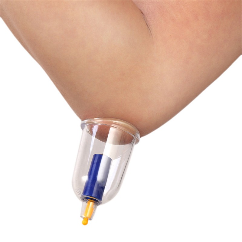 24pcs U shape Cups Chinese Vacuum Cupping Set Massage Therapy